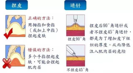 捏皮进针有讲究 捏皮进针有讲究