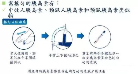 混悬型胰岛素需摇匀 混悬型胰岛素需摇匀